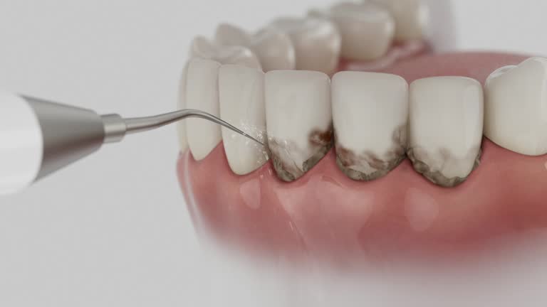 Trusted Teeth Cleaning And Checkup service in El Paso, TX - Dentist Open Now